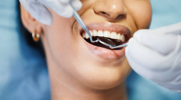Best Walk-In Emergency Dental Services in Belwood, NC