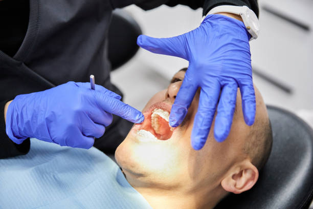 Best Emergency Root Canal Therapy in Belwood, NC